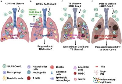 Diverse interactions of Mycobacterium tuberculosis infection and of BCG vaccination with SARS-CoV-2